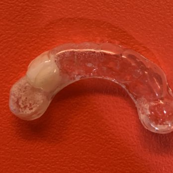 Mahshid Mirghassemi, D.D.S, PC - This what it looks like - General Dentistry Near Me - Danvers, Massachusetts Mahshid Mirghassemi, D.D.S, PC - This what it looks like - General Dentistry Near Me - Danvers, Massachusetts