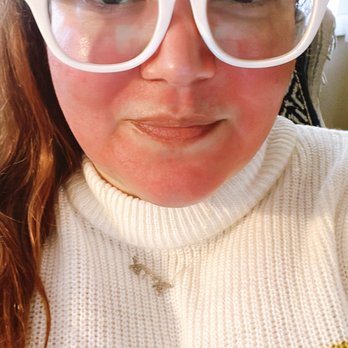 Elegant Aesthetics - easy-breezy (only stayed red for a few hours)...love love love vampire facials! - Medical Spas Near Me - Riverside, California