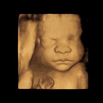 True Ultrasound - Ultrasound Imaging Centers Near Me - Lake Forest, California