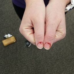 I went in for nail polish and left with bleeding cuticles I went in for nail polish and left with bleeding cuticles
