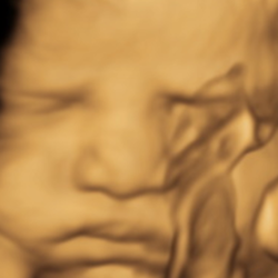 Classy Babie - 3D Ultrasound photo