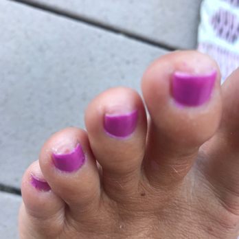 TK Nails & Spa - More broken skin - Nail Salons Near Me - Auburn, California TK Nails & Spa - More broken skin - Nail Salons Near Me - Auburn, California