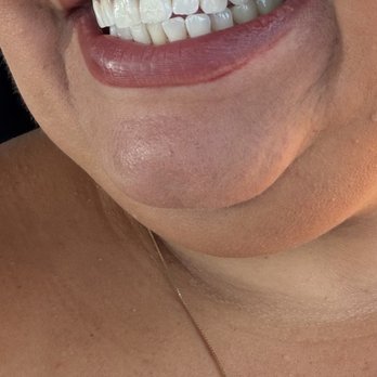 Atlantic Dental Group - Let's play...which teeth are fake? - Cosmetic Dentists Near Me - Whittier, California Atlantic Dental Group - Let's play...which teeth are fake? - Cosmetic Dentists Near Me - Whittier, California