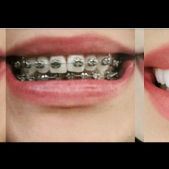 Ehrler Orthodontics - Orthodontists Near Me - Redlands, California