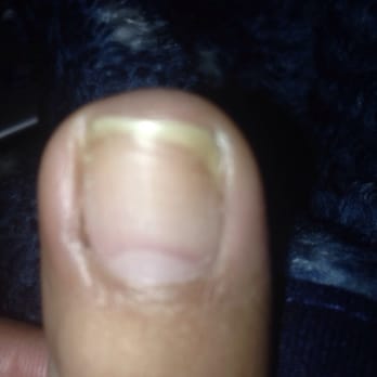 Artemis Nail Lounge - they yanked the cuticle deep from the left side of my toe. It's finally scabbed and not raw anymore - Nail Salons Near Me - Pasadena, California Artemis Nail Lounge - they yanked the cuticle deep from the left side of my toe. It's finally scabbed and not raw anymore - Nail Salons Near Me - Pasadena, California