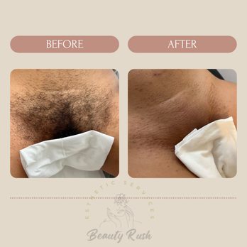 Beauty Rush Bar - Sugaring Near Me - New York, New York Beauty Rush Bar - Sugaring Near Me - New York, New York