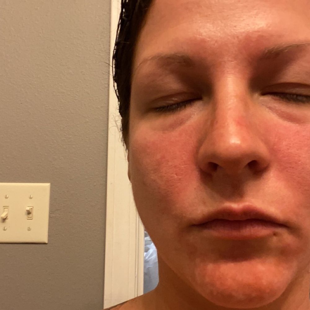 Palm Beach Tan - Blotchy face uneven color - Spray Tanning Near Me - Springfield, Missouri Palm Beach Tan - Blotchy face uneven color - Spray Tanning Near Me - Springfield, Missouri