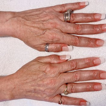 Vip Nails Camby - Acrylic French Tip - Nail Salons Near Me - Indianapolis, Indiana Vip Nails Camby - Acrylic French Tip - Nail Salons Near Me - Indianapolis, Indiana