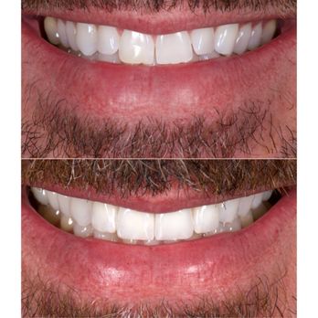 Pinar&Wagner - Cosmetic Dentists Near Me - West Hollywood, California Pinar&Wagner - Cosmetic Dentists Near Me - West Hollywood, California