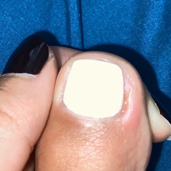 Noire The Nail Bar - Infection, drainage coming out of the "ingrown" she removed - Waxing Near Me - Gainesville, Florida