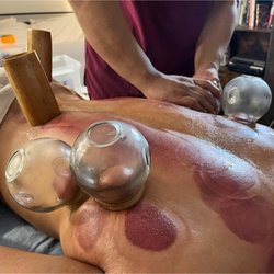 Cupping for male athelete