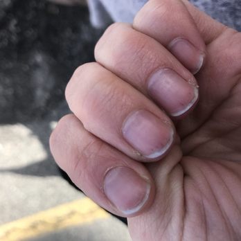 Magic Nails - My nails 2 days after shellac removal - Nail Salons Near Me - Winchester, Virginia