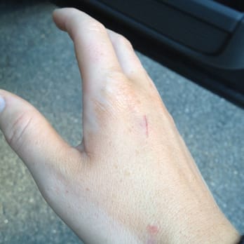 ENVY Tanning Salon - Blotchy hand (and I washed them right after too, it wouldn't come off) - Tanning Near Me - Plaistow, New Hampshire