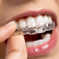 Dynamic Dental Group, PC - Dynamic Dental Group patient consultation with Invisalign in Vandalia, IL