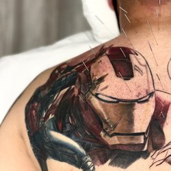 iHeal Wellness Clinic - Acupuncture for upper back and shoulder blade persistent paint