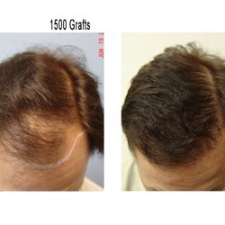Sacramento Hair Doctor