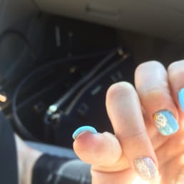 My burnt missing skin and messed up skin under the nail