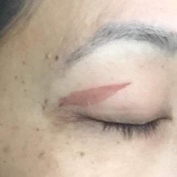 reWAXation - Update 11/30/18: Day 3 of the damaged area. - Spray Tanning Near Me - San Francisco, California