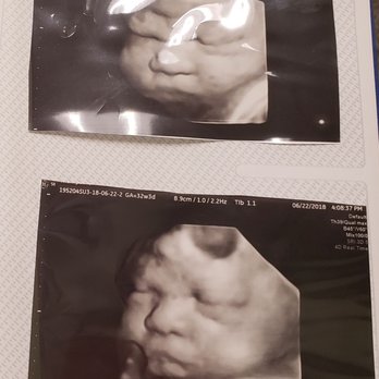 Sacramento Imaging - Love this pic of my baby boy! Cant wait to meet him! - Diagnostic Imaging Near Me - Sacramento, California