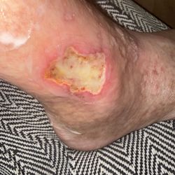 CareNow Urgent Care - Austin