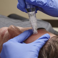 Medical Skin Aesthetics - SkinPen® Elite Microneedling