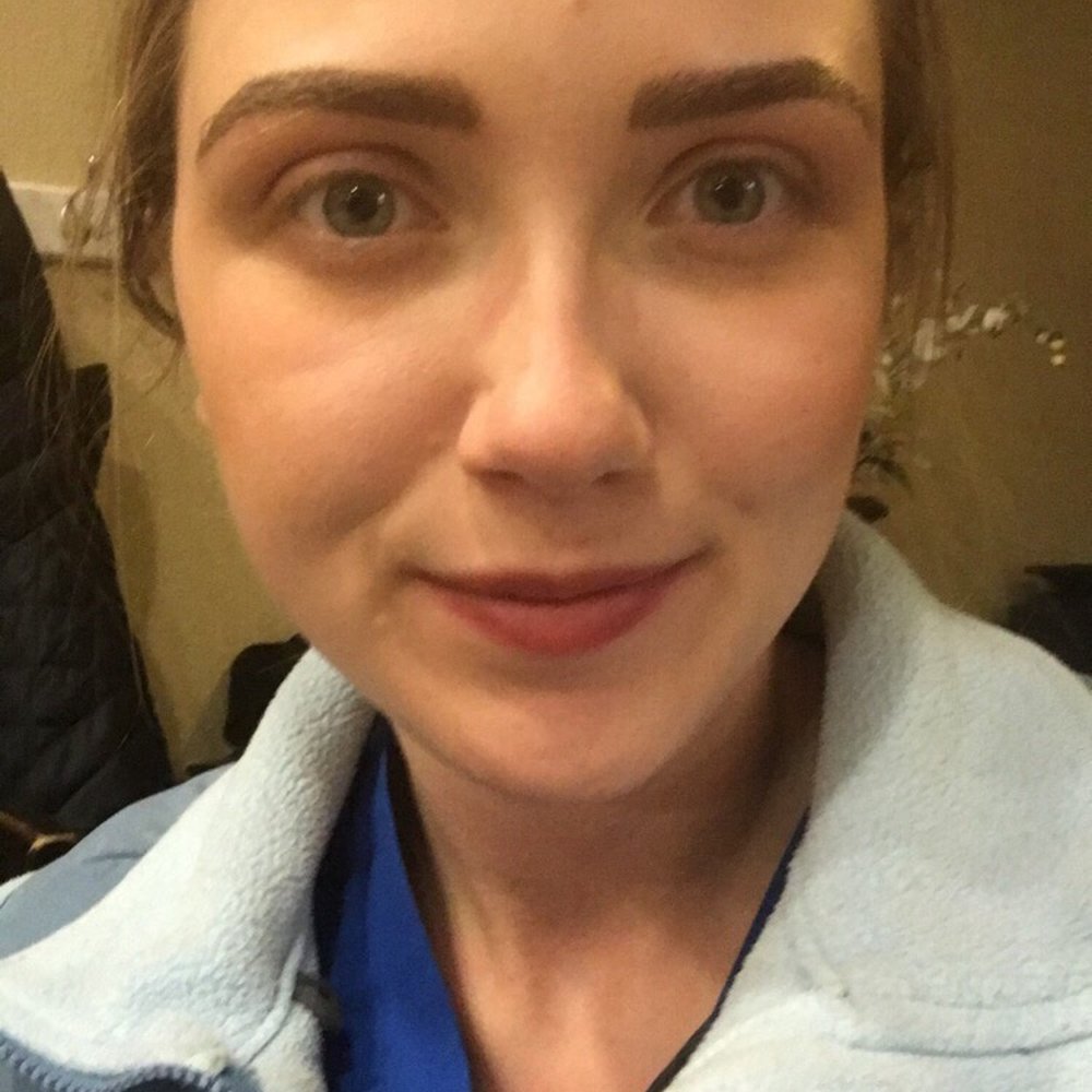 Illuminated Skincare - Brows after my 2nd session today (not healed yet) - Skin Care Near Me - Rocklin, California Illuminated Skincare - Brows after my 2nd session today (not healed yet) - Skin Care Near Me - Rocklin, California