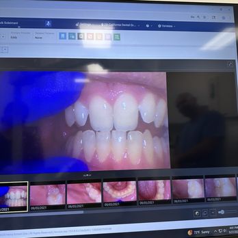 California Dental Group - Before - General Dentistry Near Me - Eagle Rock, California California Dental Group - Before - General Dentistry Near Me - Eagle Rock, California