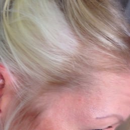 Supposed to be highlights! Now I have huge white patches!!!:( Supposed to be highlights! Now I have huge white patches!!!:(