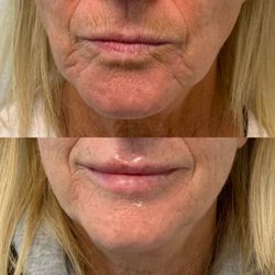 Pure Beauty Medical Spa