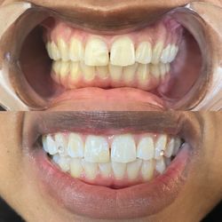 Fancy Esthetics - Teeth whitening and gem, book Fancy Smile