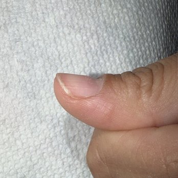 Red Carpet Nails and Spa - Dent in right thumb. - Nail Salons Near Me - Albuquerque, New Mexico Red Carpet Nails and Spa - Dent in right thumb. - Nail Salons Near Me - Albuquerque, New Mexico