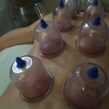 Mending Roots Body Therapies - Cupping therapy- awwww my new favorite! Pulls all the stagnant lymph to the surface to be cleared out by the circulatory system! - Massage Therapy Near Me - Eureka, California