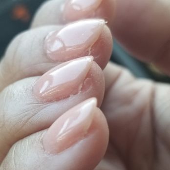 Bella Nails - Unacceptable. The white you see the actual meat of my nail beds because she filed them too many times during the dip manicure process - Nail Salons Near Me - Belmont, California Bella Nails - Unacceptable. The white you see the actual meat of my nail beds because she filed them too many times during the dip manicure process - Nail Salons Near Me - Belmont, California