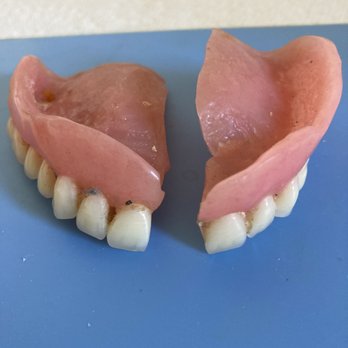 Affordable Denture Repair - Before - General Dentistry Near Me - Boston, Massachusetts Affordable Denture Repair - Before - General Dentistry Near Me - Boston, Massachusetts