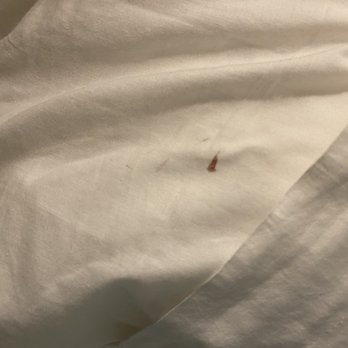 York Beach Surf Club - Blood on pillow - Hotels Near Me - York, Maine York Beach Surf Club - Blood on pillow - Hotels Near Me - York, Maine