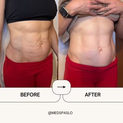 Medspa Slo