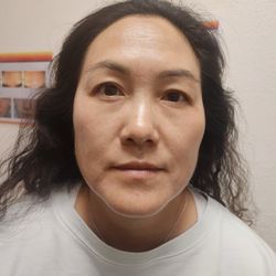 Esther Choi - After treatments.