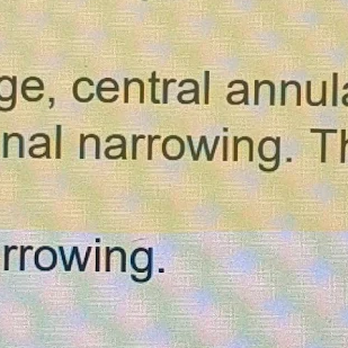 Fort Wayne Orthopedics - The proof she lied and downplay my condition and said the MRI found nothing at all. Abbey is lying. I'M ALWAYS IN PAIN. - Orthopedists Near Me - Fort Wayne, Indiana