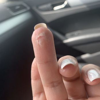 Illinois Nails - From leaving my fingers in acetone for long. - Nail Salons Near Me - Round Lake Beach, Illinois