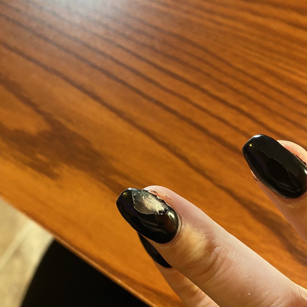 Gel polish peeled off