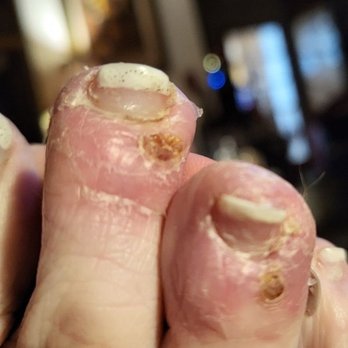 Love Nails and Spa - Two weeks later - Nail Technicians Near Me - Monterey, California