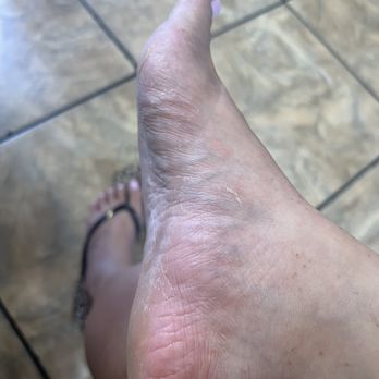 Golden Nails - Dry skin and feet are still gross with callus. She hardly scrubbed anything. - Nail Salons Near Me - Arroyo Grande, California