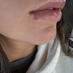 1 Week after