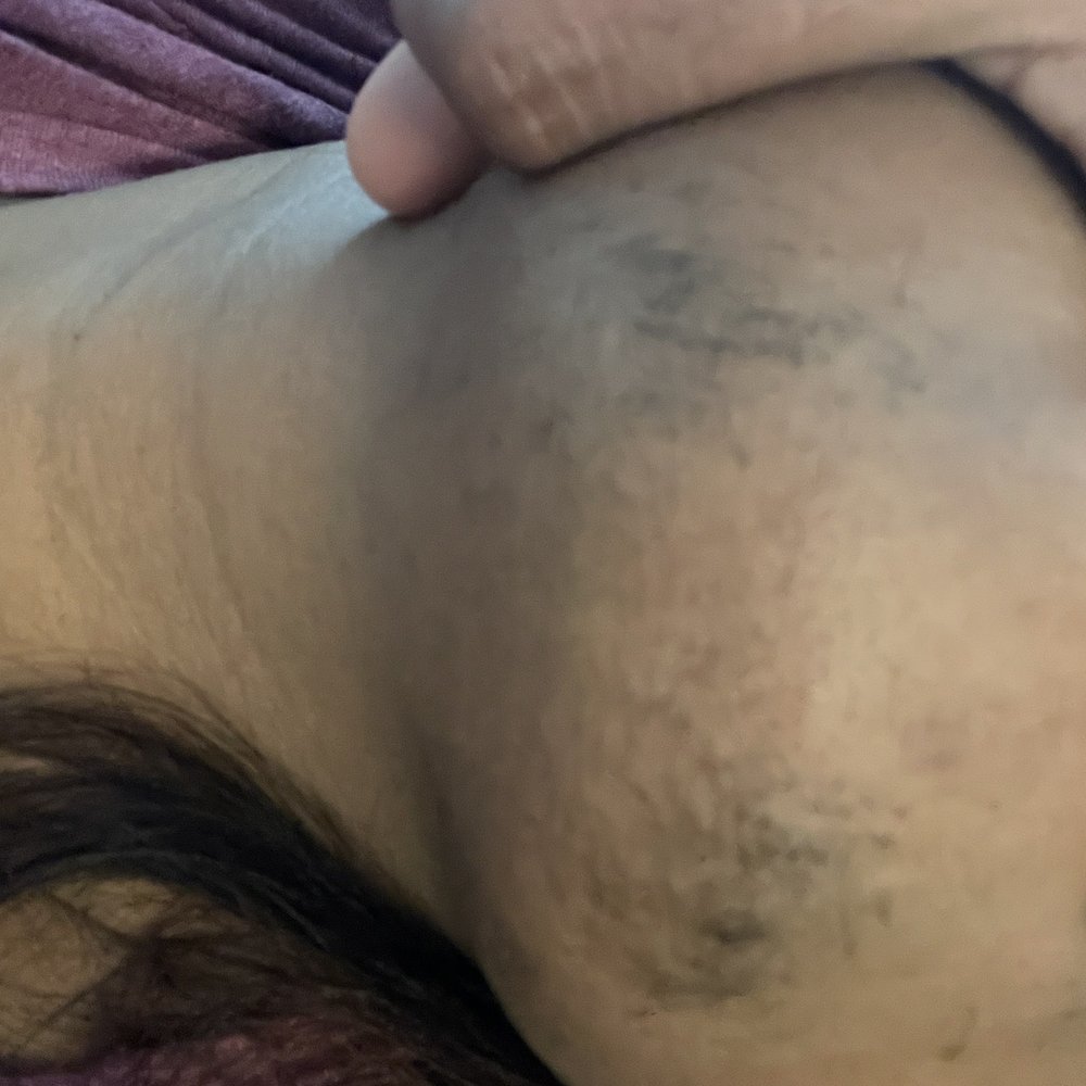 Gul A Zikria, MD FACOG - Chin hair growth - Obstetricians & Gynecologists Near Me - Milpitas, California Gul A Zikria, MD FACOG - Chin hair growth - Obstetricians & Gynecologists Near Me - Milpitas, California