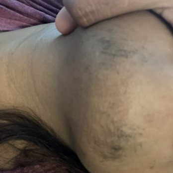 Gul A Zikria, MD FACOG - Chin hair growth - Obstetricians & Gynecologists Near Me - Milpitas, California