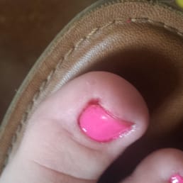 My sister-in-law's bleeding big toe and subpar paint job. They clearly didn't GAF. My sister-in-law's bleeding big toe and subpar paint job. They clearly didn't GAF.