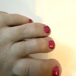 Un-trimmed, uneven nails