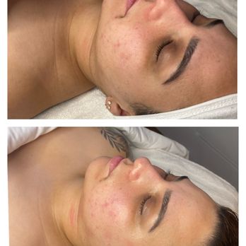 SD Skin Aesthetics - Massage Near Me - La Mesa, California SD Skin Aesthetics - Massage Near Me - La Mesa, California