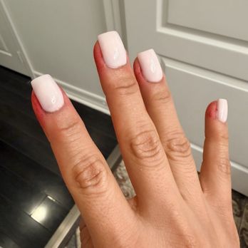 Apple Nails & Spa - Same day.  Hours later.  Contact dermatitis & irritation from overfilling . - Nail Salons Near Me - San Diego, California