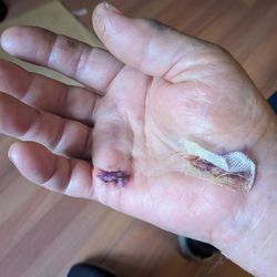 Shasta Orthopaedics - Pure pain